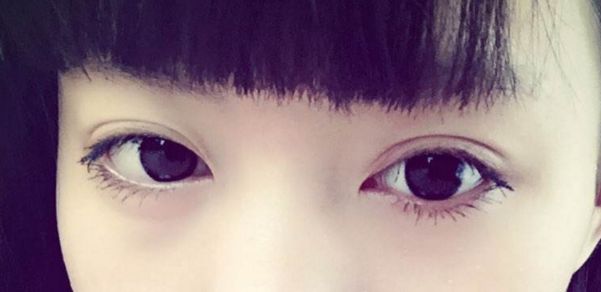 靠前重慶眼部整形醫(yī)院榜單出爐，時(shí)光整形受認(rèn)可