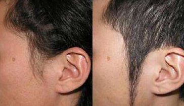 北京輕醫(yī)美整形醫(yī)院推薦，微整形首選！