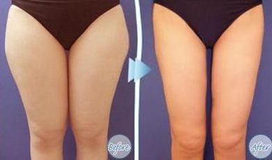 杭州痤瘡修復?？漆t(yī)院推薦