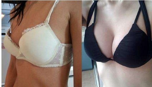 長(zhǎng)沙雙眼皮手術(shù)：田芳斌與解燦哪位醫(yī)生更優(yōu)秀？前五專家詳細(xì)介紹！有必要留存~