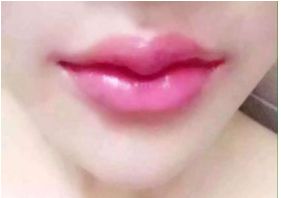 有哪些北京玻尿酸醫(yī)院值得推薦？這是前五家醫(yī)院強(qiáng)烈推薦的！