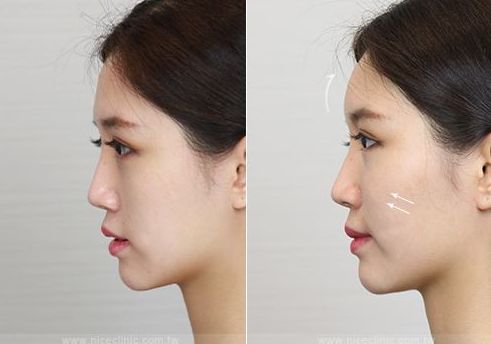 2023年郴州市比較好的整形醫(yī)院推薦