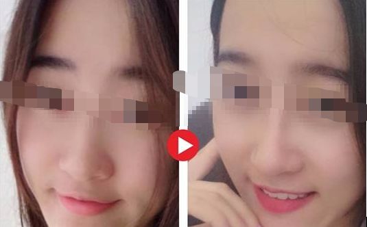 【2024年】蘇州哪家整形醫(yī)院口碑最好？評選出的前三強(qiáng)！