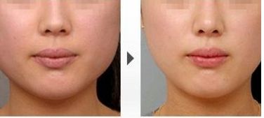 復旦大學附屬眼耳鼻喉科醫(yī)院：綜合淺談上海五官科醫(yī)療中心魅力