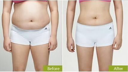 廣州雙眼皮整形醫(yī)院排名前十榜單已定！難道紫馨和軍美是口碑比較好的選擇？