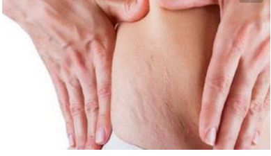 重慶亞美醫(yī)院楊武林醫(yī)生的眼部手術(shù)效果如何？