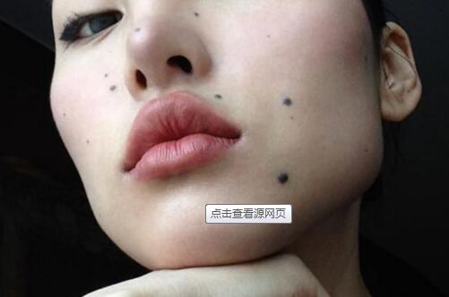 湖南長沙雙眼皮醫(yī)生前十出爐！有沒有專門修復單眼皮的醫(yī)生？