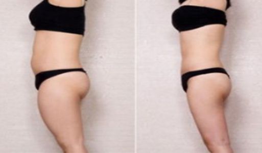 蘇州整容美容科醫(yī)院排行榜top6：鼻部整容實(shí)力醫(yī)院大揭秘！