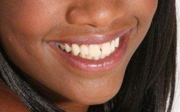 2023年河南哪家醫(yī)院手術消除動態(tài)細紋效果更佳？全新美容醫(yī)院排行榜曝光！