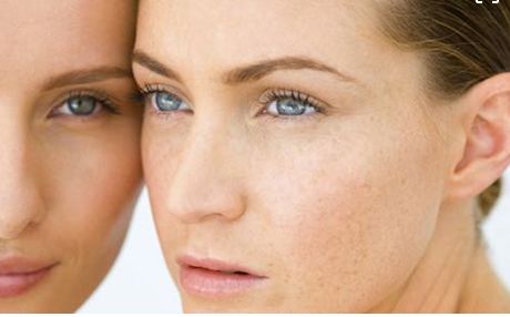 成都當(dāng)?shù)孛廊菡吾t(yī)院鼻部整形效果如何？真實案例發(fā)布！