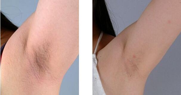 2023長春市中心醫(yī)院整形外科價格如何？【宋彬】醫(yī)生經(jīng)驗分享真可信嗎？