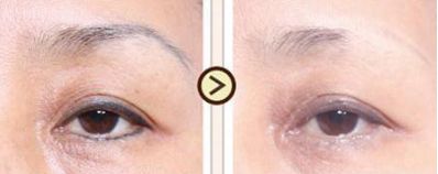 杭州哪家醫(yī)院是種植頭發(fā)領(lǐng)域的翹楚