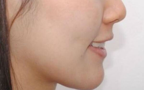 如何在鎮(zhèn)江芘麗芙美容醫(yī)院找到更適合您的服務(wù)與技術(shù)？