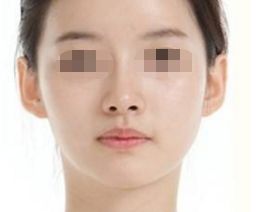 深圳市幾家好的三甲整形醫(yī)院推薦