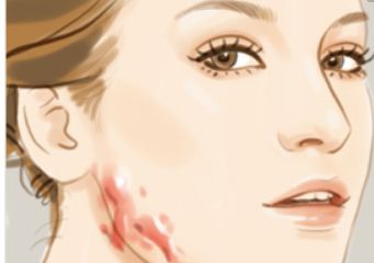 北京哪家醫(yī)院可以洗紋身呢？