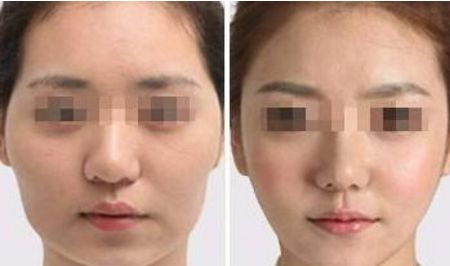 杭州美容整形醫(yī)院排名：一覽無余，了解內(nèi)容不容錯(cuò)過！