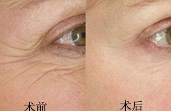 南京鳳凰島整形外科門診部的王科醫(yī)生口碑如何？聯(lián)合李敏醫(yī)生介紹及手術(shù)后的反饋，揭秘這位醫(yī)生的實(shí)力！