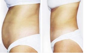 廣州優(yōu)質(zhì)整形醫(yī)院綜合排行榜！合法可信，花樣百出！