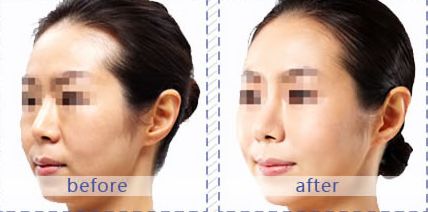 成都哪家醫(yī)院適合皮膚美容？