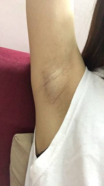 上海健橋植發(fā)技術(shù)實(shí)力如何？頭發(fā)再生效果值得期待嗎？