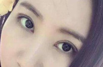 上海華東醫(yī)院整形外科主任醫(yī)師榜單揭曉！先進隆鼻療法案例分享及費用明細，急需閱讀！