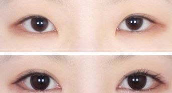 廣州韓后許滿萍醫(yī)生的專業(yè)領域揭秘，令人驚喜的嫩膚案例分享