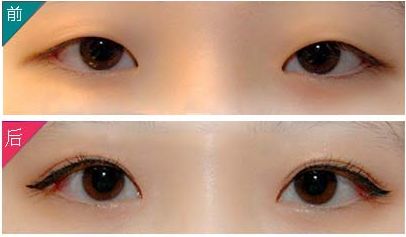 紹興有專業(yè)的肥胖科醫(yī)生，實(shí)力一流的技術(shù)吸引關(guān)注！快來(lái)看看大腿吸脂成功案例！