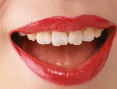 北京301醫(yī)院雷永紅如何進行雙眼皮手術(shù)？真實案例分享