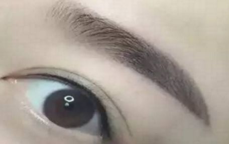 哈爾濱醫(yī)科大學(xué)二院最新整形去痦子技術(shù)揭秘，讓肌膚恢復(fù)純凈光潔