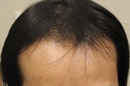 哪家醫(yī)療整形醫(yī)院是貴陽省內(nèi)口碑比較好的選擇？