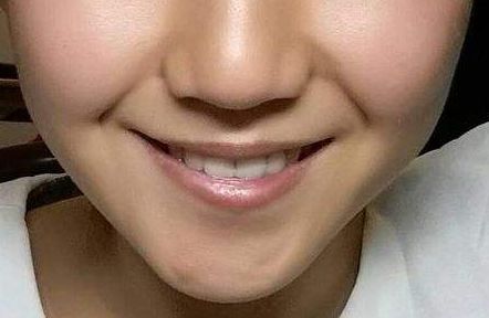 東方和諧醫(yī)療美容吸脂醫(yī)生名單曝光！專家推薦，值得關(guān)注