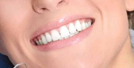 西京醫(yī)院鼻部整形丨馬顯杰教授，項目介紹與真人案例圖解析