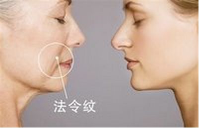 美麗改變，趙德星鼻子整形前后對(duì)比，驚艷有度！