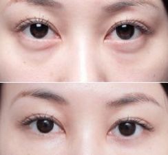 上海美萊醫(yī)院的療效一流，備受好評的醫(yī)生大揭秘！