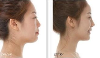 廣州植發(fā)全新醫(yī)院排行榜，權(quán)威榜單公布，趕緊收藏！