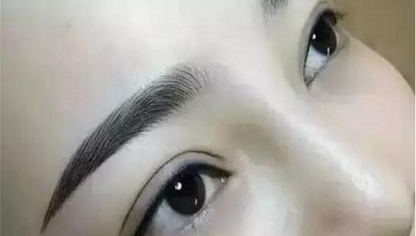 重慶曹陽的鼻子整形效果如何？醫(yī)生手藝獨(dú)步天下的真實案例分享