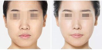 深圳整形美容醫(yī)院排名前十，哪家更受用戶好評(píng)？