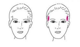 長沙去斑哪家醫(yī)院效果好？三甲醫(yī)院推薦！