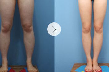 上海整容醫(yī)院排行：領(lǐng)先全球的磨骨技術(shù)，醫(yī)院評分驚人！