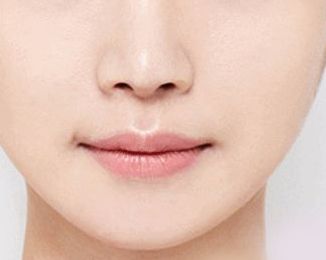 空軍總醫(yī)院眼袋手術(shù)費(fèi)用及技術(shù)解析，醫(yī)師解讀+成功案例分享