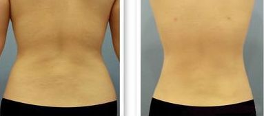 2023年溫州地區(qū)出現(xiàn)多位肋骨鼻醫(yī)生上榜！