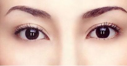 霍玉旺：中國鼻型塑造的頂尖大師！真實(shí)案例揭秘！