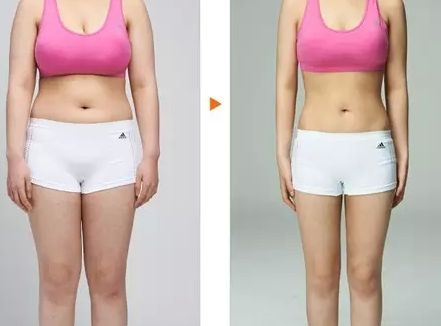 貴陽(yáng)市雙眼皮整形醫(yī)院推薦！四家專(zhuān)業(yè)醫(yī)院綜合對(duì)比