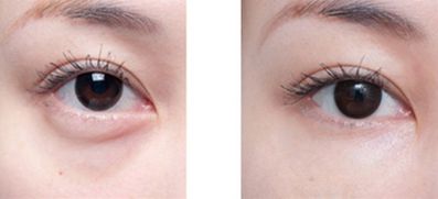 沈陽(yáng)整形醫(yī)院精心挑選，排名領(lǐng)先醫(yī)院揭曉