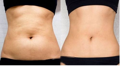 上海葉麗萍醫(yī)生進(jìn)行鼻部整形效果如何？最新成功案例曝光