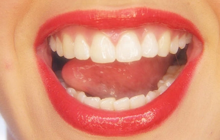 北京八大處有哪些專業(yè)的吸脂醫(yī)生？高端專家如何排隊(duì)？吸脂手術(shù)收費(fèi)標(biāo)準(zhǔn)及參考價(jià)格都有哪些呢？