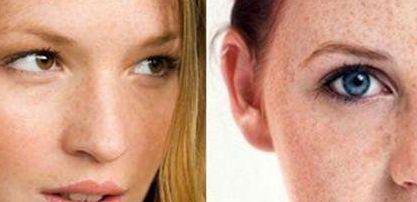 黃久佐醫(yī)生為你分享雙眼皮效果及技術(shù)測(cè)評(píng)！