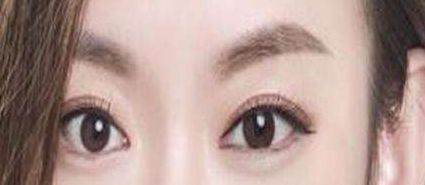 貴陽美貝爾徐威鼻子整形效果如何？90天親身經(jīng)歷曝光案例揭秘