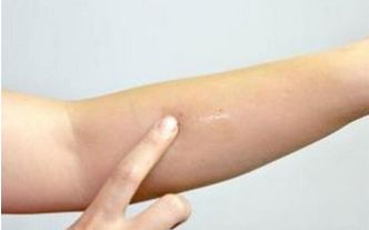 上海脂肪抽吸醫(yī)生技術(shù)大比拼，排行前十新榜單揭曉