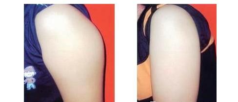 上海九院的整形價格表是怎樣的？它適合想要變美的人嗎？